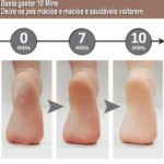 Lixa de Pé Elétrica Lixador Elimina Calo Portátil Usb